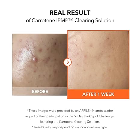 APRILSKIN-Carrotene IPMP Clearing Solution