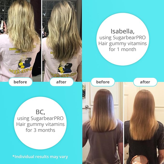 Sugar Bear Hair - Hair Vitamins, 60 Veggie Gummies, Prevents Loss of Hair