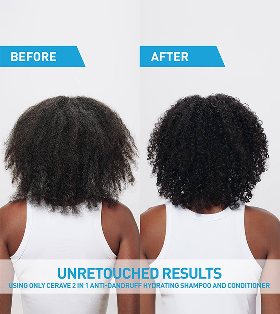 CeraVe 2-in-1 Anti-Dandruff Hydrating Shampoo and Conditioner