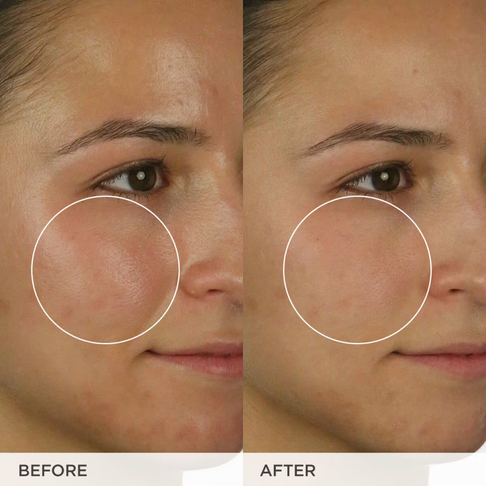 The Matcha Cleanse - Daily Clarifying Gel Cleanser