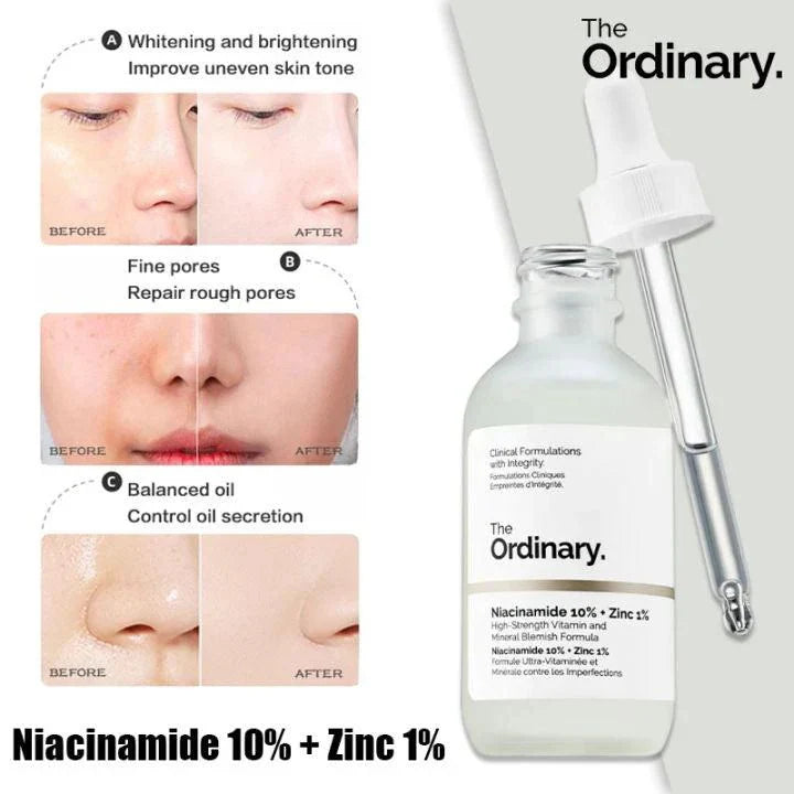 The Ordinary Niacinamide 10% + Zinc 1% Serum
