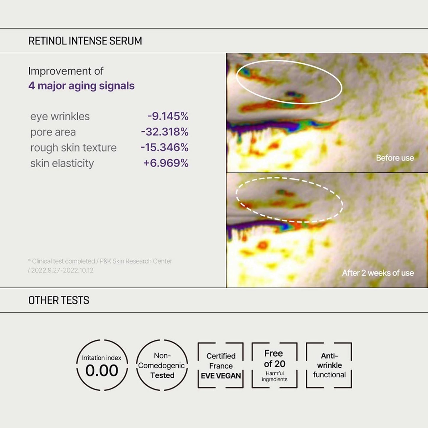 SOME BY MI - Retinol Intense Trial Kit - Serum and Eye Cream, 0.33Oz