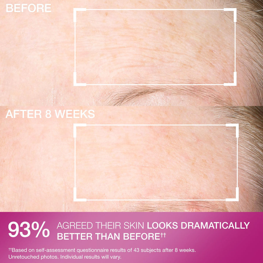 StriVectin SD Advanced Plus Intensive Moisturizing Concentrate