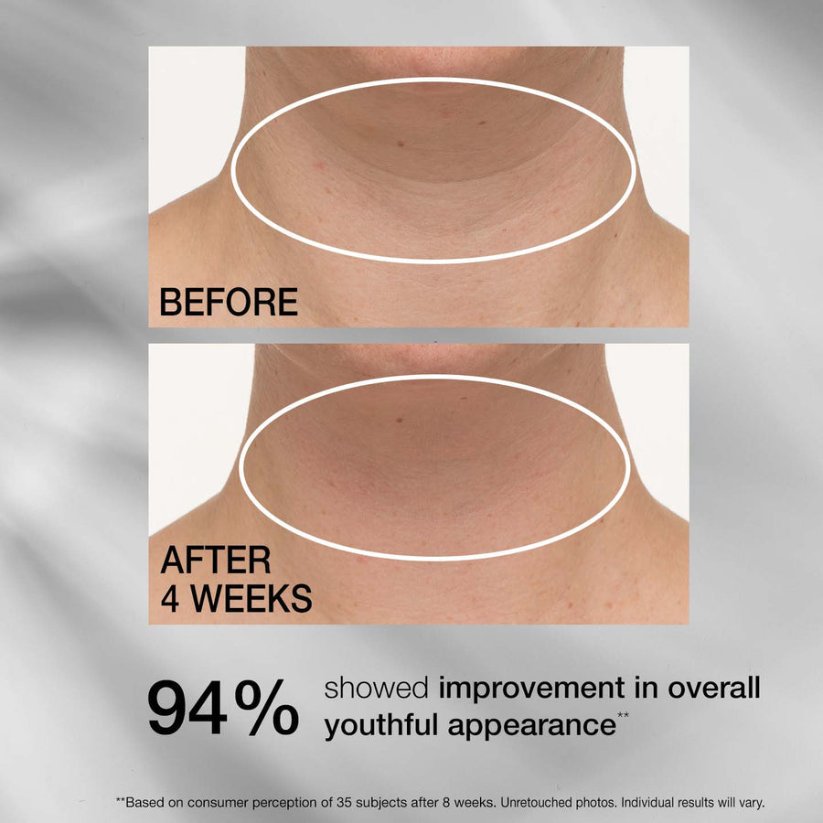 StriVectin TL Advanced Tightening Neck Cream PLUS