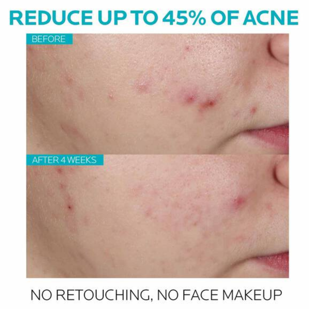 La Roche Posay | Effaclar Salicylic Acid Acne Treatment Serum | Anit Acne - Pore-Refining - 1.5% Salicylic Acid Serum Treatment for Acne