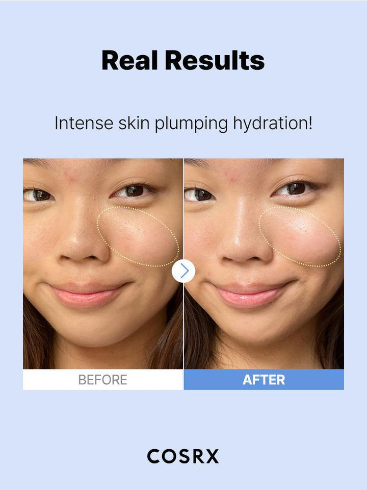 COSRX The Hyaluronic Acid 3 Serum – Intensive Hydration & Moisture-Boosting Serum