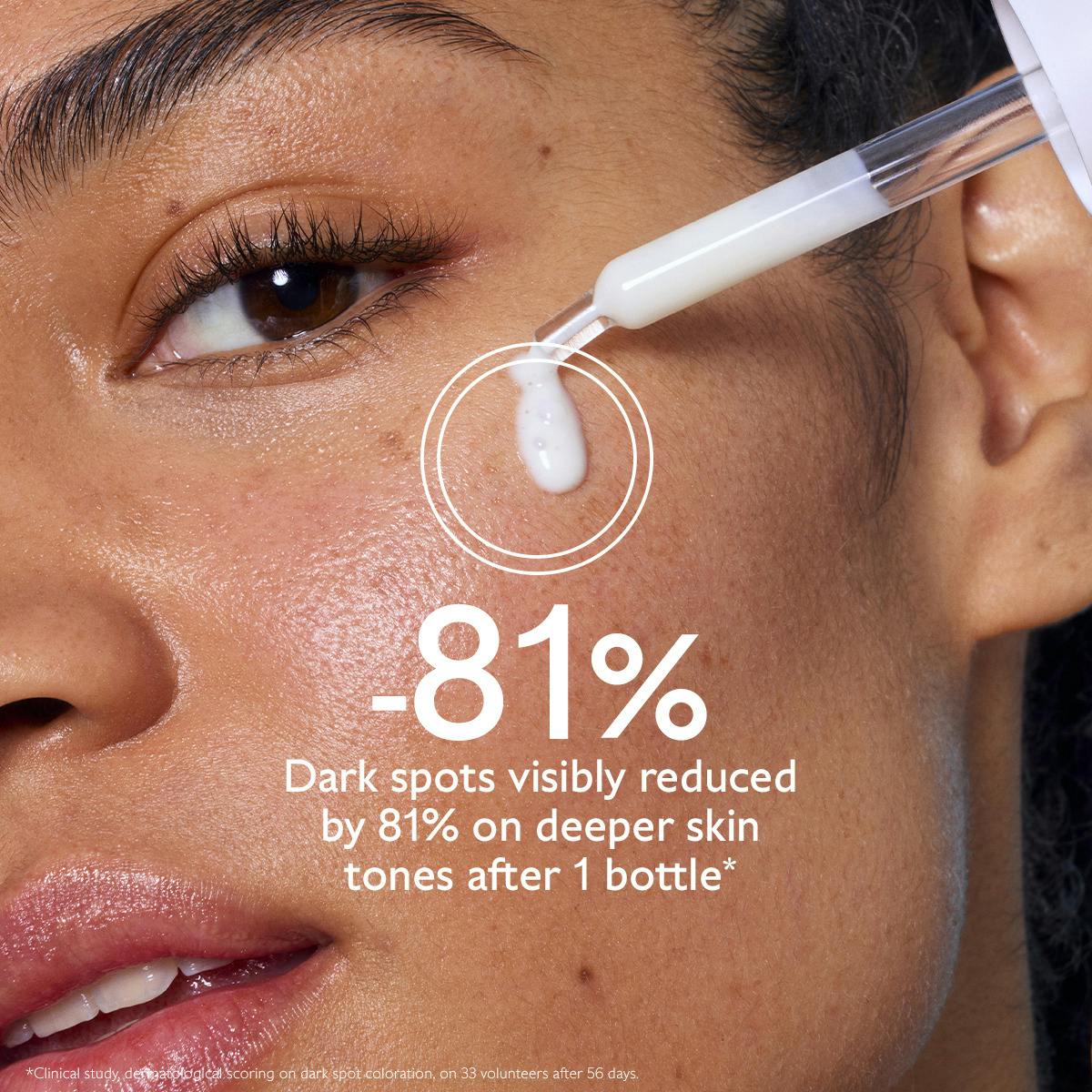 Caudalie Vinoperfect Brightening Dark Spot Serum – Radiance Boosting & Anti-Dark Spot Powerhouse