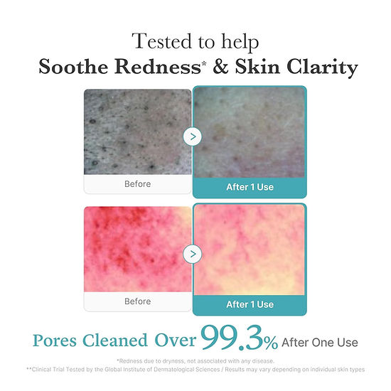 Medicube - Azelaic Acid Foam Cleanser