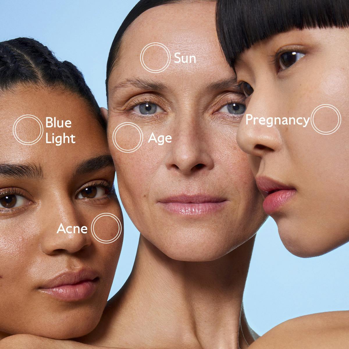 Caudalie Vinoperfect Brightening Dark Spot Serum – Radiance Boosting & Anti-Dark Spot Powerhouse