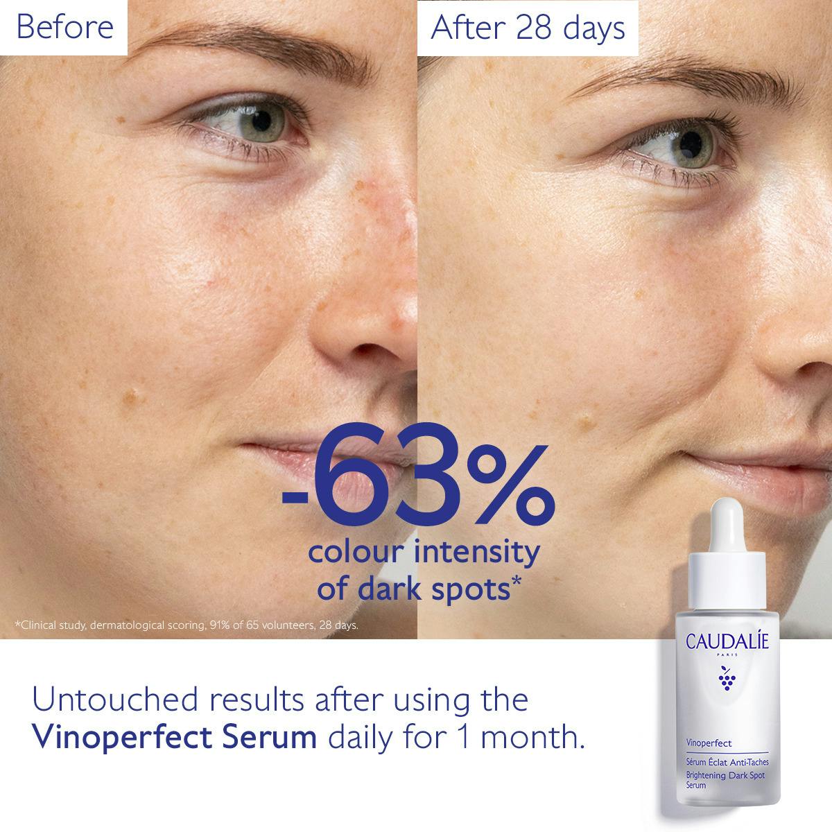 Caudalie Vinoperfect Brightening Dark Spot Serum – Radiance Boosting & Anti-Dark Spot Powerhouse