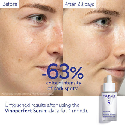 Caudalie Vinoperfect Brightening Dark Spot Serum – Radiance Boosting & Anti-Dark Spot Powerhouse