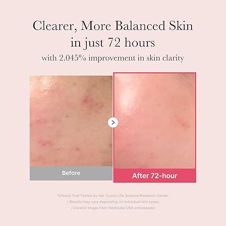 Medicube TXA Niacinamide 15% Glow Facial Serum