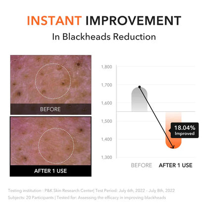 Aprilskin - Carrotene IPMP™ Hydromelt Cleansing Balm - 90ml