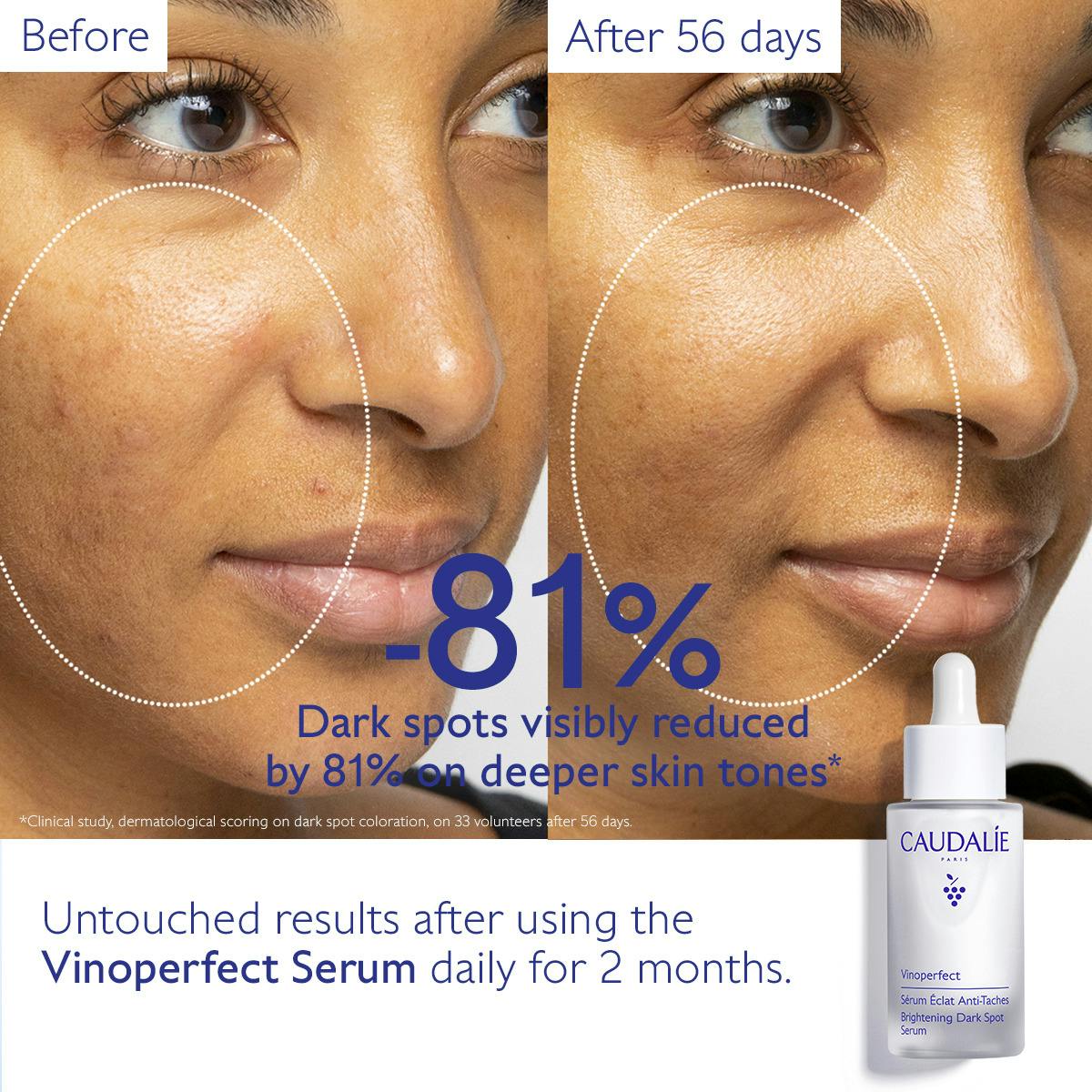 Caudalie Vinoperfect Brightening Dark Spot Serum – Radiance Boosting & Anti-Dark Spot Powerhouse