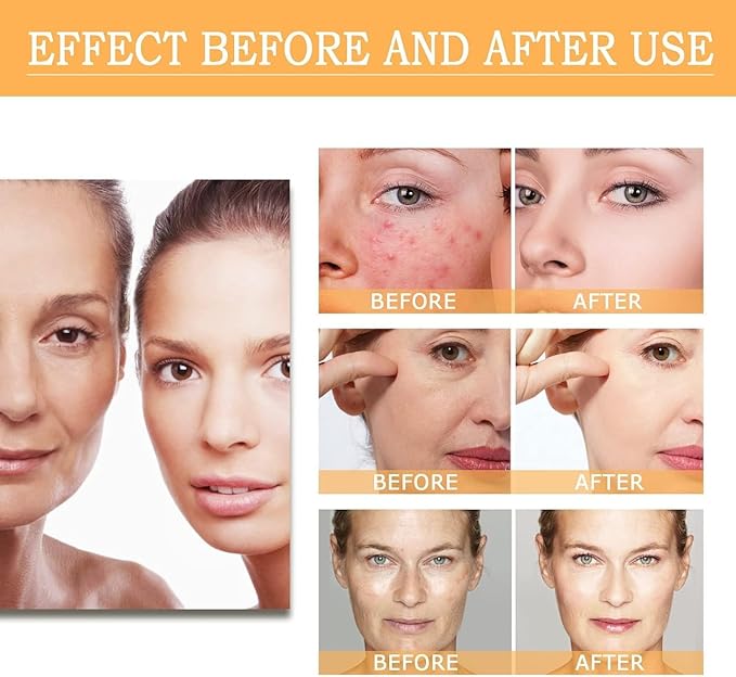 Glycolic Acid Toning Solution, Glycolic Acid 7% Toner, Glycolic Sour 7% Toning