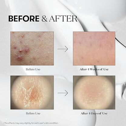 VT COSMETICS CICA Reedle Shot