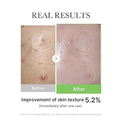 MEDICUBE - Exosome Cica Calming Ampoule - 30ML