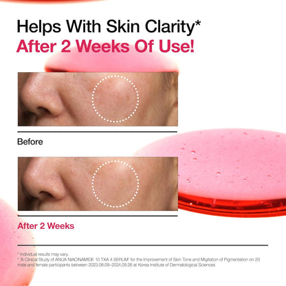 ANUA Niacinamide 10 + TXA 4 Serum with Hyaluronic Acid