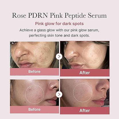 Medicube PDRN Pink Peptide Serum, Pink glow serum