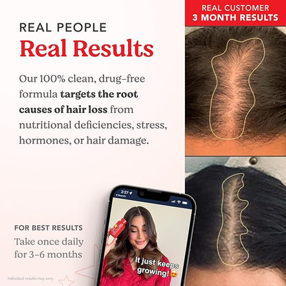 HAIRtamin Advanced Formula Hair Vitamins for Women & Men | Vegan 5000 Mcg Biotin