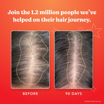 HAIRtamin Advanced Formula Hair Vitamins for Women & Men | Vegan 5000 Mcg Biotin