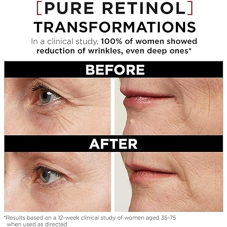 'L'Oreal Paris Revitalift Triple Power LZR Retinol Night Serum