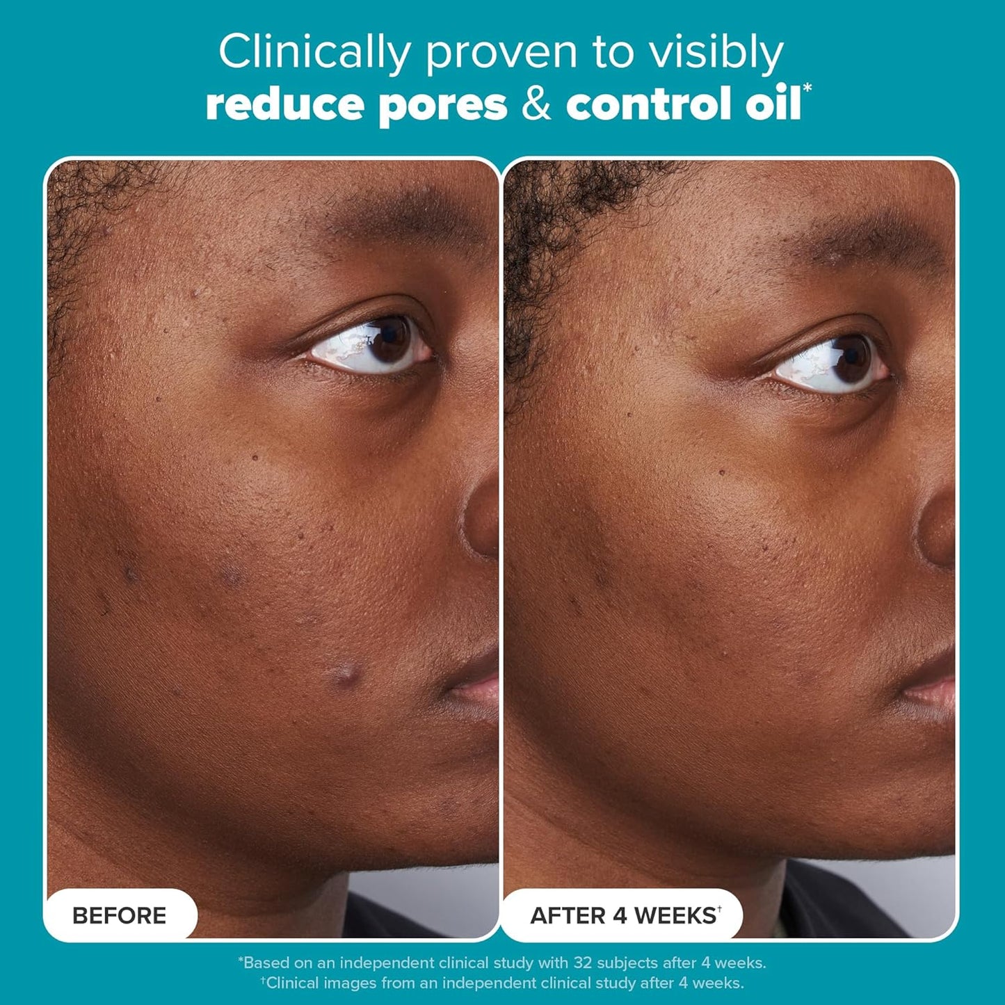 Paula’s Choice Skin Perfecting 2% BHA Liquid Exfoliant