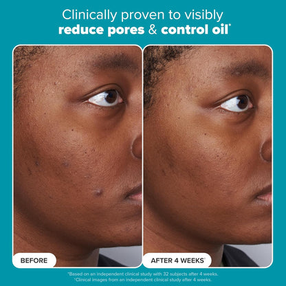 Paula’s Choice Skin Perfecting 2% BHA Liquid Exfoliant