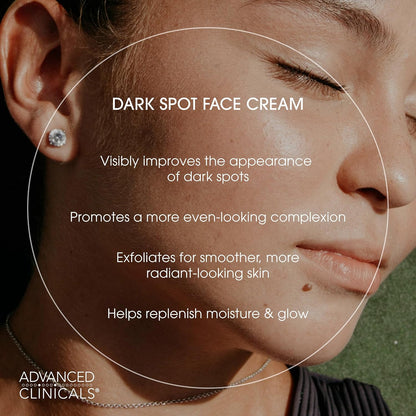Advanced Clinicals Dark Spot Brightening Cream