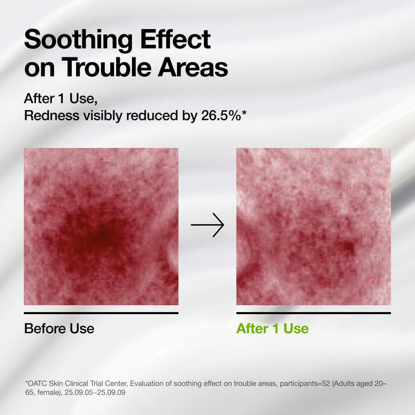 Anua Azelaic Acid CICA Skin Soothing Moisturizer