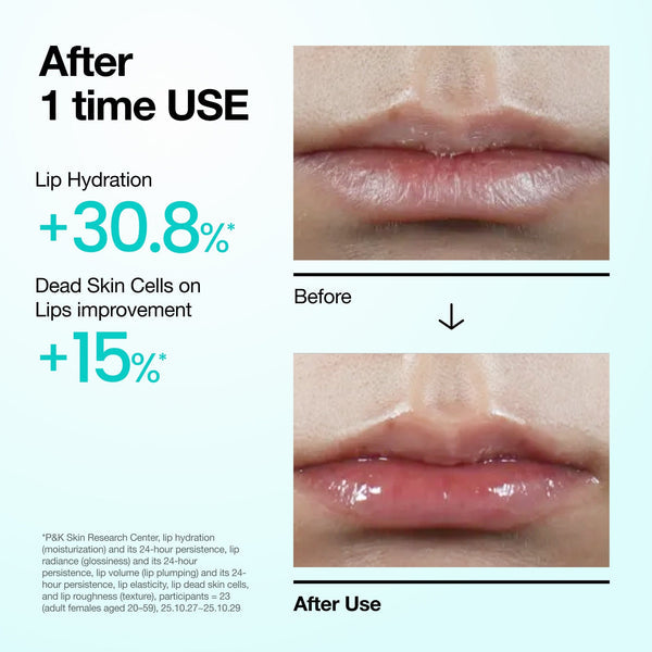 Anua PDRN Hyaluron Lip Serum