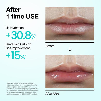 Anua PDRN Hyaluron Lip Serum