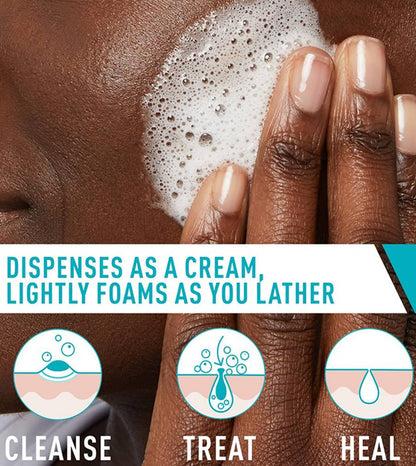 CeraVe Acne Foaming Cream Cleanser – 4% Benzoyl Peroxide
