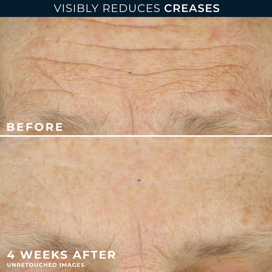 RoC Multi Correxion Crépe Repair Face & Neck Cream