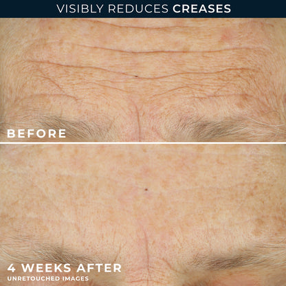 RoC Multi Correxion Crépe Repair Face & Neck Cream