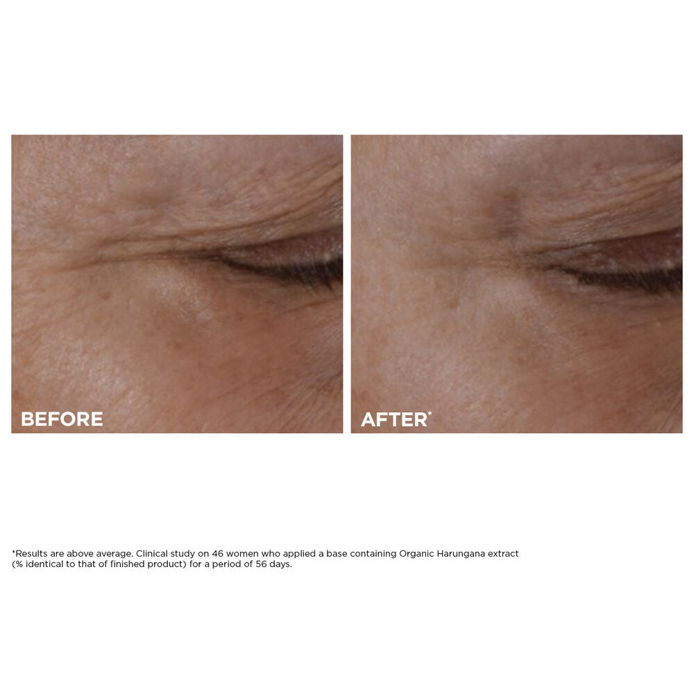 Clarins-Total Eye Lift: Firming Under-Eye Cream for Wrinkles