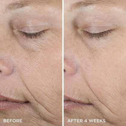 TACHA THE DEWY SERUM Resurfacing & Plumping Treatment