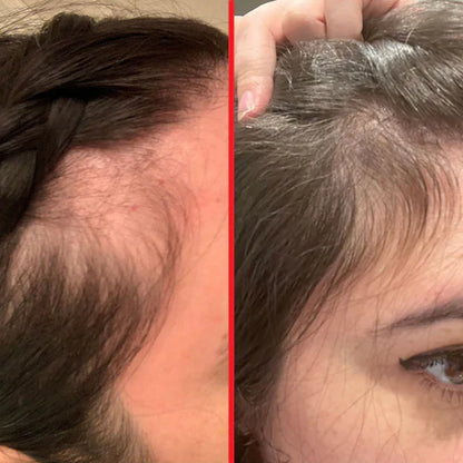 Hairtamin Advanced Formula-Diatery supplement