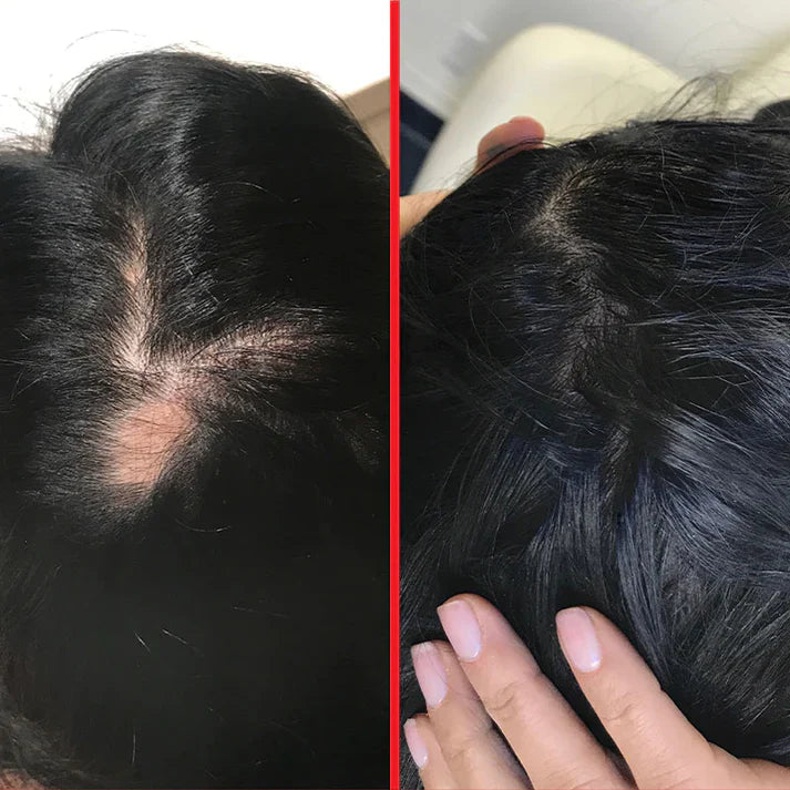 Hairtamin Advanced Formula-Diatery supplement