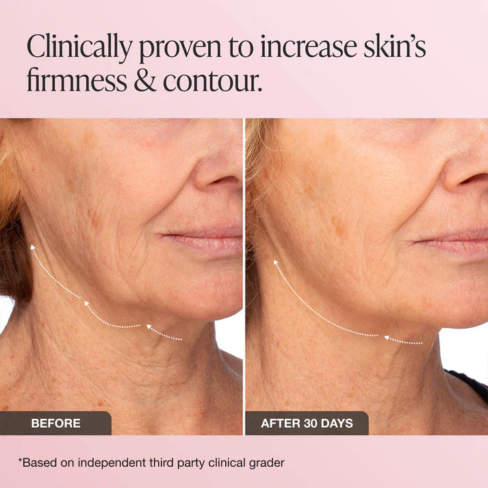 INNBEAUTY Project - Extreme Cream Moisturizer - 50ml