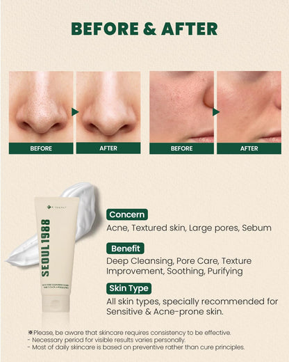 K-Secret Seoul 1988 Cleansing Foam: Pine Cica 1% + Probiotics