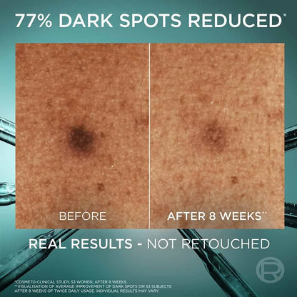 L'Oréal Paris Bright Reveal Niacinamide Dark Spot Serum 10%