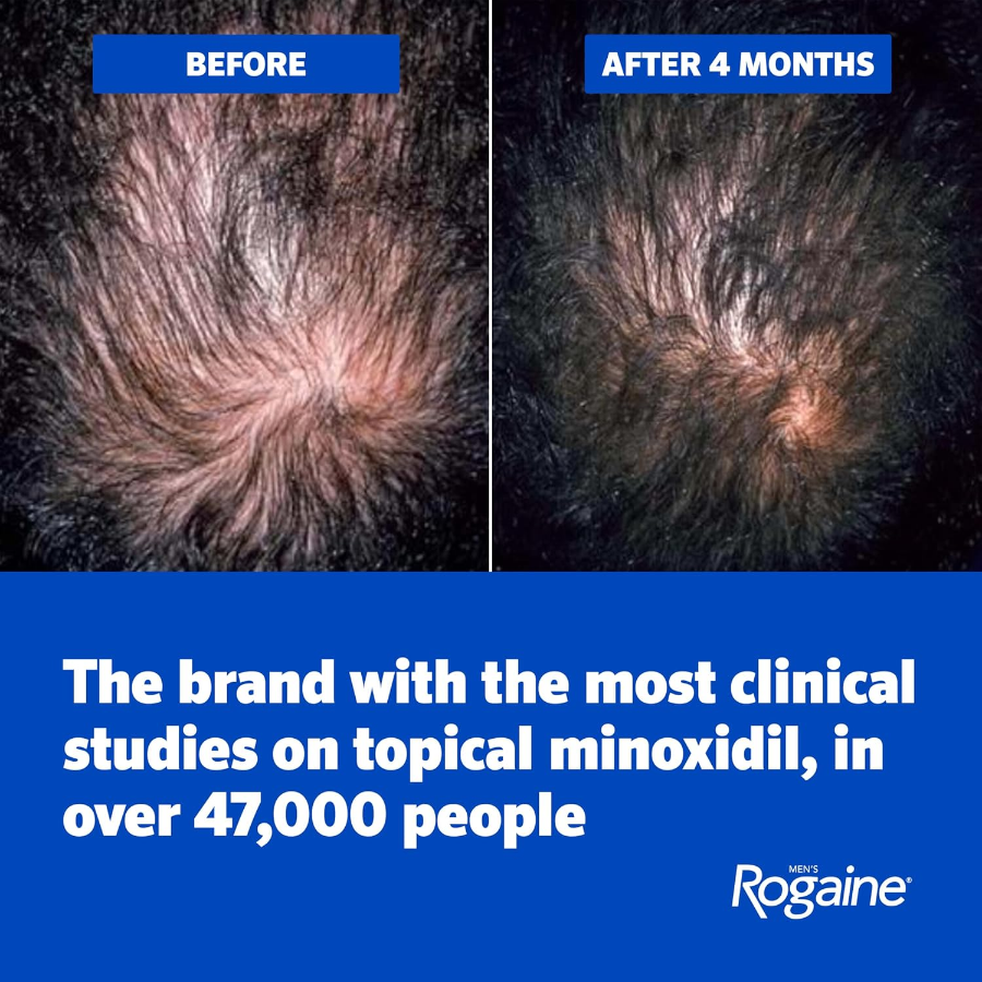 Men's Rogaine Extra Strength 5% Minoxidil Topical Solution