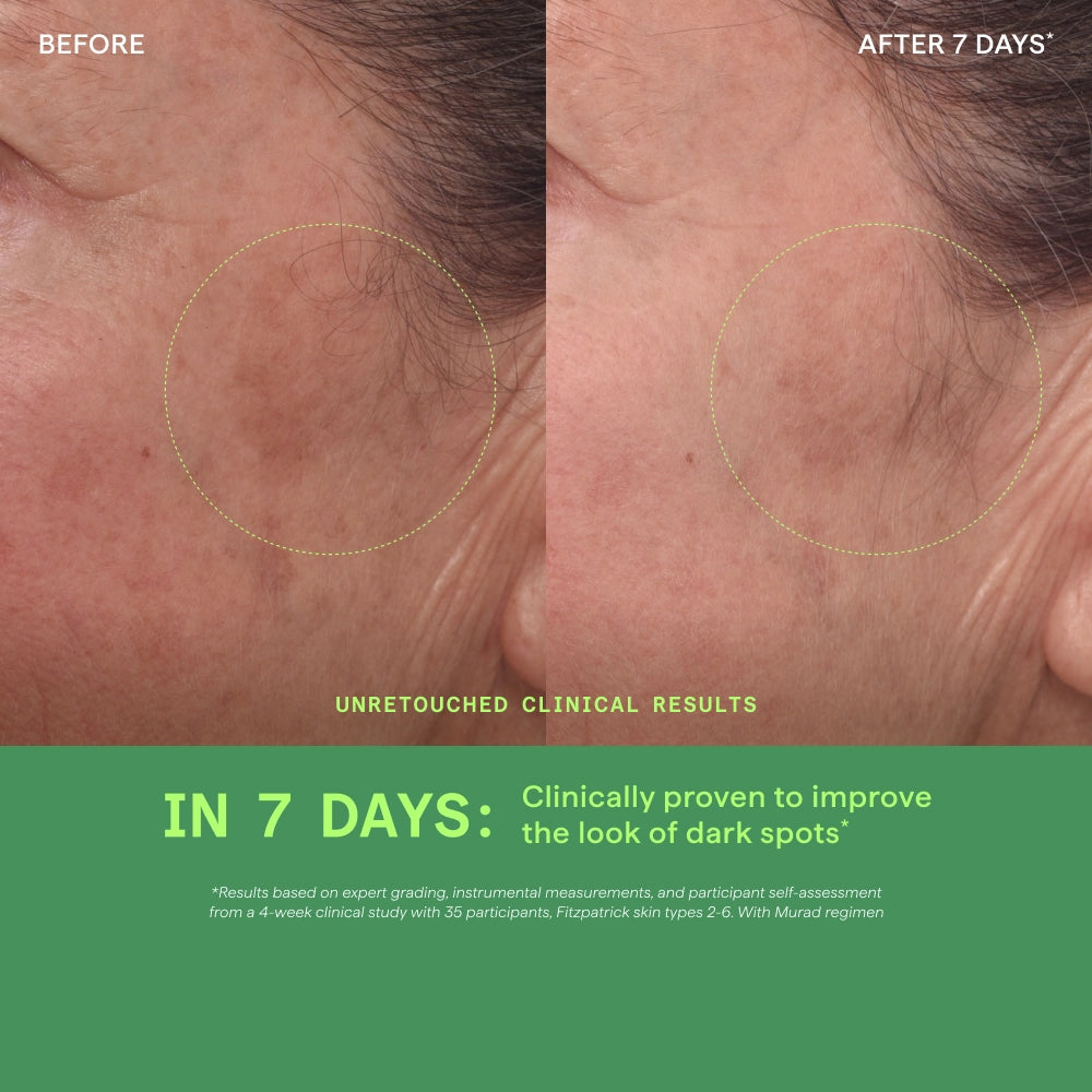 Murad Environmental Shield Rapid Dark Spot Correcting Serum