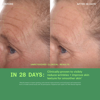 Murad Environmental Shield Rapid Dark Spot Correcting Serum