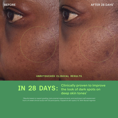 Murad Environmental Shield Rapid Dark Spot Correcting Serum