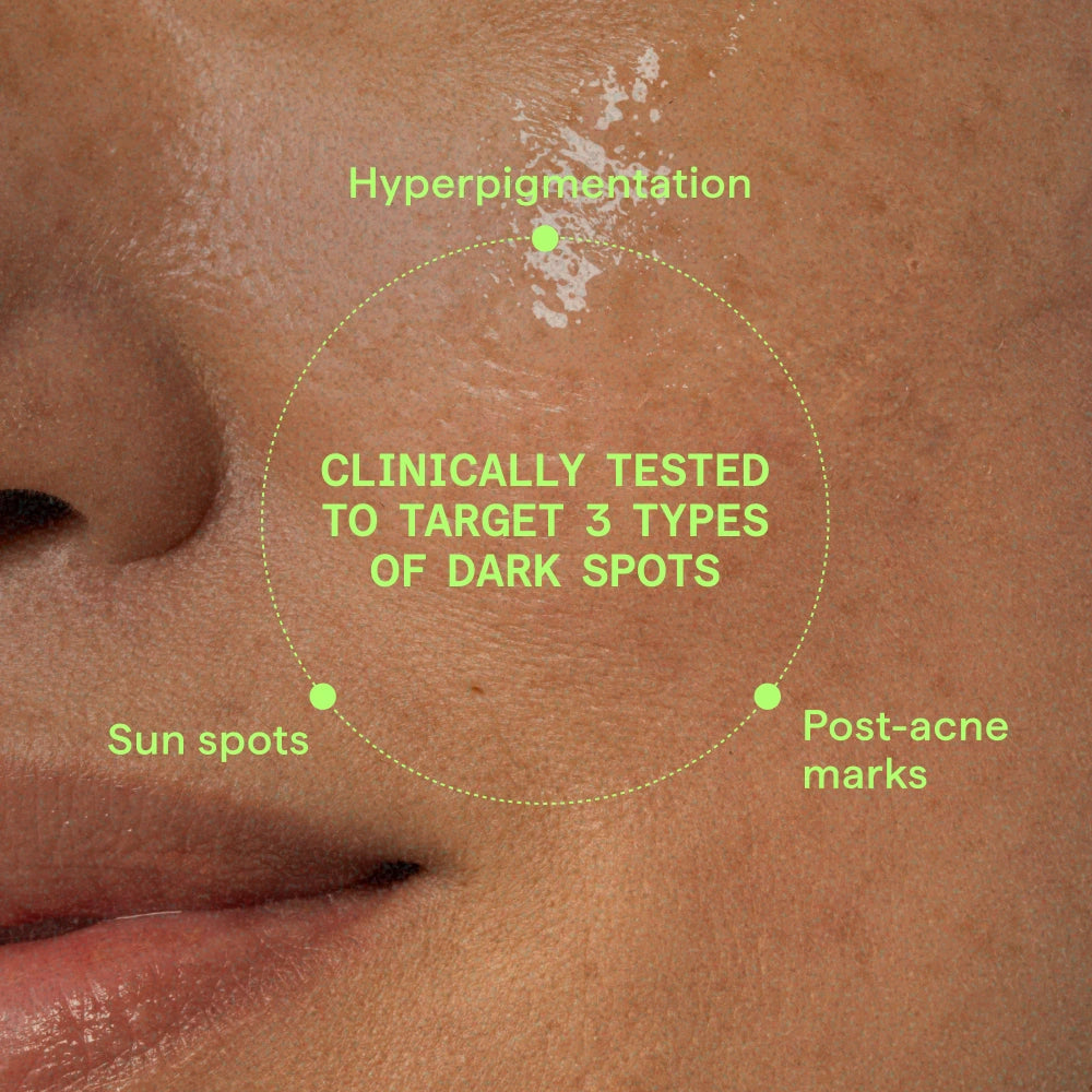Murad Environmental Shield Rapid Dark Spot Correcting Serum