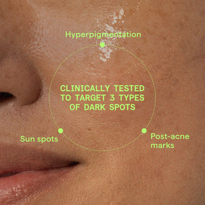 Murad Environmental Shield Rapid Dark Spot Correcting Serum