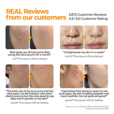 Numbuzin No. 5 Goodbye Blemish Serum