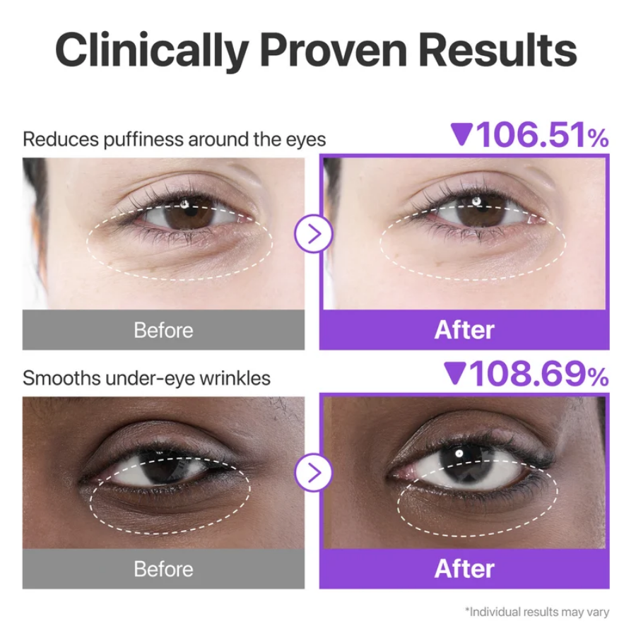 Numbuzin No. 9 NAD+ Collagen Under Eye Patch